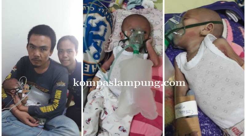 Mikhayla Bayi Perempuan Usia 4 Bulan Butuh Uluran Tangan  Para Dermawan