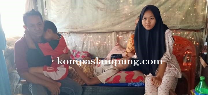 Derita Penyakit Langka Asnawati Butuh Uluran Tangan Untuk Pengobatan